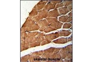 Formalin-fixed and paraffin-embedded human skeletal muscle reacted with CCHCR1 Antibody (Center), which was peroxidase-conjugated to the secondary antibody, followed by DAB staining.