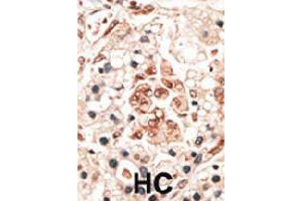Hippocalcin Antikörper  (N-Term)