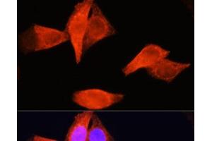 Immunofluorescence analysis of HeLa cells using PSAT1 Polyclonal Antibody at dilution of 1:100 (40x lens). (PSAT1 antibody)