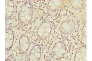 Immunohistochemistry of paraffin-embedded human colon tissue using ABIN7170174 at dilution of 1:100 (SLC23A2 antibody  (AA 1-90))