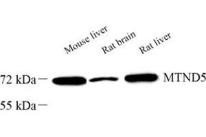 Western blot analysis of MTND5 (ABIN7074659) at dilution of 1: 1000 (MT-ND5 antibody)