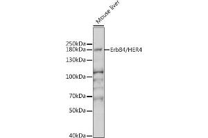 Western blot analysis of extracts of mouse brain, using ErbB4/HER4 antibody (ABIN6131263, ABIN6140257, ABIN6140260 and ABIN6221732) at 1:1000 dilution. (ERBB4 antibody  (AA 26-160))