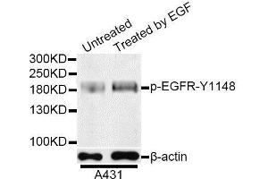 Western blot analysis of extracts of A-431 cells, using Phospho-EGFR-Y1148 antibody. (EGFR antibody  (pTyr1148))