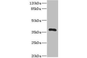 Western blot All lanes: NTM antibody IgG at 2. (Neurotrimin antibody  (AA 30-316))