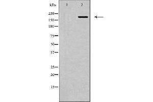 Western blot analysis of MYLK expression in HepG2 cells. (MYLK antibody  (C-Term))