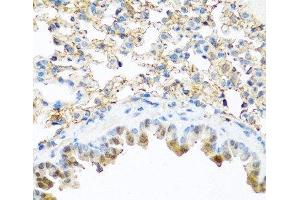 Immunohistochemistry of paraffin-embedded Mouse lung using PI3 Polyclonal Antibody at dilution of 1:100 (40x lens). (PI3 antibody)