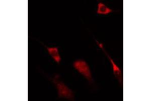 ABIN6274323 staining HT29 cells by IF/ICC. (NCBP1 antibody  (N-Term))