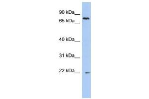NHLRC2 antibody used at 1 ug/ml to detect target protein. (NHLRC2 antibody  (N-Term))