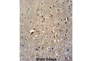 Immunohistochemistry (IHC) image for anti-PAP Associated Domain Containing 4 (PAPD4) antibody (ABIN3002233) (PAPD4 antibody)