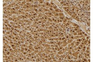 ABIN6275033 at 1/100 staining Mouse liver tissue by IHC-P.