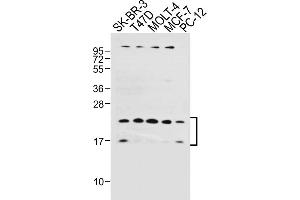 All lanes : Anti-UBE2W Antibody (C-term) at 1:1000 dilution Lane 1: SK-BR-3 whole cell lysate Lane 2: T47D whole cell lysate Lane 3: MOLT-4 whole cell lysate Lane 4: MCF-7 whole cell lysate Lane 5: PC-12 whole cell lysate Lysates/proteins at 20 μg per lane. (UBE2W antibody  (C-Term))