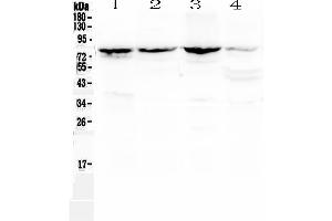 Western blot analysis of Calpain 2 using anti-Calpain 2 antibody .
