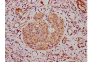 Immunohistochemistry (IHC) image for anti-CD63 (CD63) (AA 103-203) antibody (ABIN7147174)