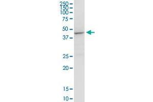 ACADM MaxPab rabbit polyclonal antibody. (Medium-Chain Specific Acyl-CoA Dehydrogenase, Mitochondrial (AA 1-421) antibody)