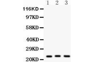 Western Blotting (WB) image for anti-Peroxiredoxin 5 (PRDX5) (AA 66-198) antibody (ABIN3043906) (Peroxiredoxin 5 antibody  (AA 66-198))