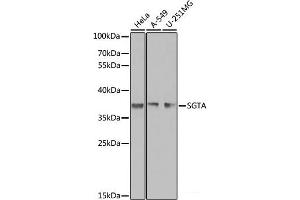 Western blot analysis of extracts of various cell lines using SGTA Polyclonal Antibody at dilution of 1:1000. (SGTA antibody)