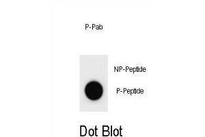 Dot blot analysis of Mouse p21Cip1 Antibody (Phospho ) Phospho-specific Pab (ABIN1881616 and ABIN2837842) on nitrocellulose membrane. (p21 antibody  (pSer125))