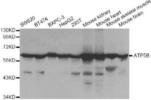 Western blot analysis of extracts of various cell lines, using ATP5B antibody. (ATP5B antibody)