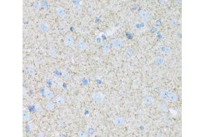 Immunohistochemistry of paraffin-embedded Mouse brain using ATP1B2 Polyclonal Antibody at dilution of 1:100 (40x lens).