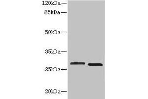 Western blot All lanes: CRYBB1 antibody at 1. (CRYBB1 antibody  (AA 1-252))