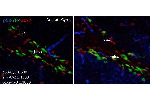 Immunohistochemistry of Mouse anti-p53 antibody. (p53 antibody)