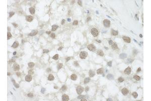 anti-DEAH (Asp-Glu-Ala-His) Box Polypeptide 36 (DHX36) (C-Term) antibody
