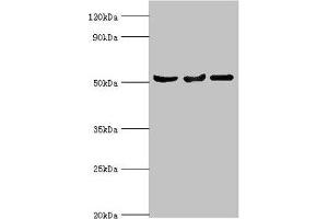 Western blot All lanes: Protein Z-dependent protease inhibitor antibody at 3 μg/mL Lane 1: Mouse liver tissue Lane 2: HepG2 whole cell lysate Lane 3: LO2 whole cell lysate Secondary Goat polyclonal to rabbit IgG at 1/10000 dilution Predicted band size: 51 kDa Observed band size: 51 kDa (SERPINA1 antibody  (AA 165-444))