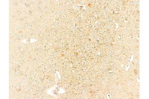 ABIN6258421 and ABIN6275697 at 1/100 staining Rat brain tissue by IHC-P.