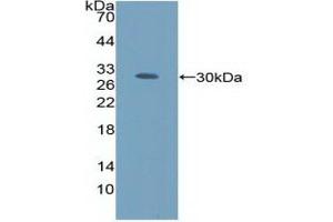 Detection of Recombinant AMFR, Human using Polyclonal Antibody to Autocrine Motility Factor Receptor (AMFR) (AMFR antibody  (AA 456-643))