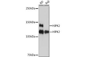 Western blot analysis of extracts of various cell lines, using HIPK2 Rabbit mAb (ABIN7267779) at 1:1000 dilution. (HIPK2 antibody)