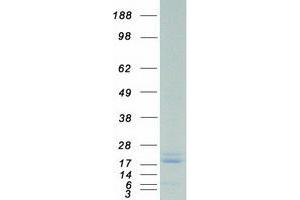 Western Blotting (WB) image for Interleukin 1 Receptor Antagonist (IL1RN) (Transcript Variant 1) protein (Myc-DYKDDDDK Tag) (ABIN2723402)