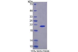 SDS-PAGE (SDS) image for phosphorylase, Glycogen, Liver (PYGL) (AA 341-509) protein (His tag) (ABIN1170569) (PYGL Protein (AA 341-509) (His tag))