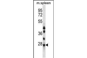 Western Blotting (WB) image for anti-NQO2 (NQO2) (AA 51-79), (N-Term) antibody (ABIN5533607)