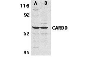 Western Blotting (WB) image for anti-Caspase Recruitment Domain Family, Member 9 (CARD9) antibody (ABIN1031698)