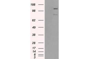 HEK293T cells were transfected with the pCMV6-ENTRY control (Left lane) or pCMV6-ENTRY BUB1B (Right lane) cDNA for 48 hrs and lysed. (BUB1B antibody)