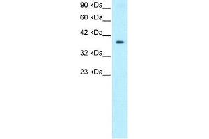 Human HepG2; WB Suggested Anti-NT5C3 Antibody Titration: 0. (NT5C3 antibody  (Middle Region))
