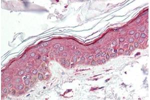 Human Skin (formalin-fixed, paraffin-embedded) stained with IL23A antibody ABIN214499 at 2. (IL23A antibody  (N-Term))