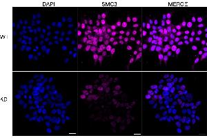 Immunocytochemical staining of HeLa cells using SMC3 antibody (ABIN7800448), 1:1,000), Top panel: wild-type (WT), Bottom panal: SMC3 shRNA knockdown (KD). (Recombinant SMC3 antibody)