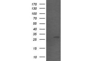 Image no. 1 for anti-Src-like-adaptor 2 (SLA2) antibody (ABIN1500952) (SLAP2 antibody)