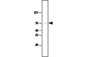 Western Blotting (WB) image for anti-SET7/9 Histone Methyltransferase (SET7/9) antibody (ABIN361068) (SET7/9 antibody)