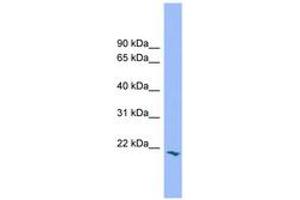 Image no. 1 for anti-Proline-Rich Gla (G-Carboxyglutamic Acid) Polypeptide 2 (PRRG2) (AA 71-120) antibody (ABIN6744772) (PRRG2 antibody  (AA 71-120))