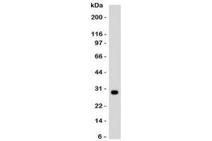 Western blot testing of Ramos lysate and HLA-DRB1 antibody. (HLA-DRB1 antibody)