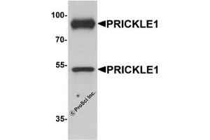 Western Blotting (WB) image for anti-Prickle-Like Protein 1 (PRICKLE1) (C-Term) antibody (ABIN1077370) (PRICKLE1 antibody  (C-Term))