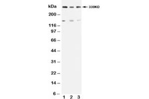Western blot testing of ATM antibody and Lane 1:  rat testis (ATM antibody  (N-Term))