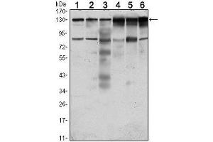 Western Blot showing PTK7 antibody used against Hela (1), A431 (2), HCT116 (3), Caco2 (4), HepG2 (5) and MCF-7 (6) cell lysate. (PTK7 antibody)