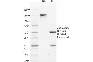 SDS-PAGE Analysis Purified Cytokeratin 1 Mouse Monoclonal Antibody (KRT1/1840). (Cytokeratin 1 antibody)
