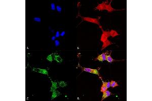 Immunocytochemistry/Immunofluorescence analysis using Mouse Anti-NALCN Monoclonal Antibody, Clone S187-7 (ABIN2483031). (NALCN antibody  (AA 1659-1738) (HRP))