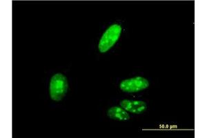 Image no. 3 for anti-Zic Family Member 4 (ZIC4) (AA 249-320) antibody (ABIN466253) (ZIC4 antibody  (AA 249-320))