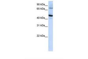 Image no. 1 for anti-Cytochrome P450, Family 46, Subfamily A, Polypeptide 1 (CYP46A1) (AA 396-445) antibody (ABIN6738089) (CYP46A1 antibody  (AA 396-445))