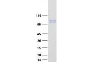 Validation with Western Blot
